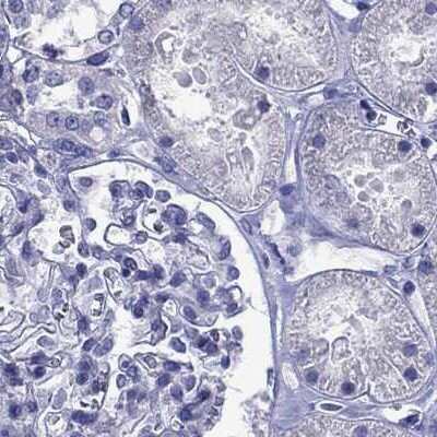 Immunohistochemistry-Paraffin: StAR Antibody [NBP1-86992]