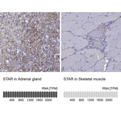 Immunohistochemistry-Paraffin: StAR Antibody [NBP1-86993]