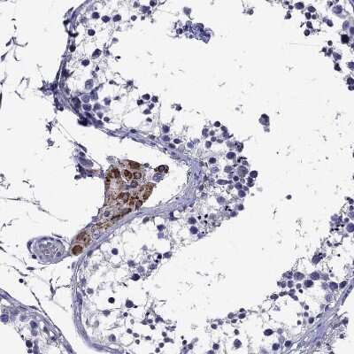 Immunohistochemistry-Paraffin: StAR Antibody [NBP1-86993]