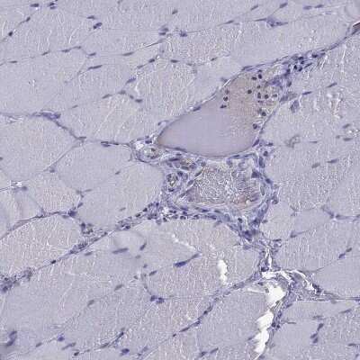 Immunohistochemistry-Paraffin: StAR Antibody [NBP1-86993]