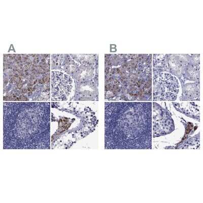 Immunohistochemistry-Paraffin: StAR Antibody [NBP1-86993]