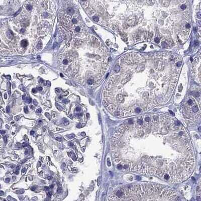 Immunohistochemistry-Paraffin: StAR Antibody [NBP1-86993]