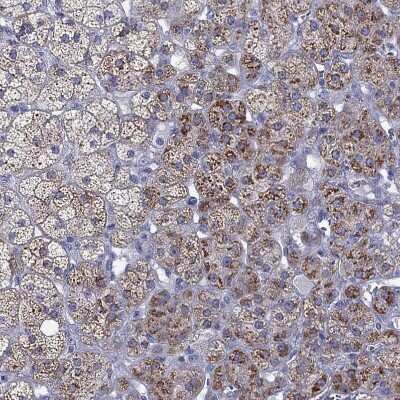 Immunohistochemistry-Paraffin: StAR Antibody [NBP1-86993]