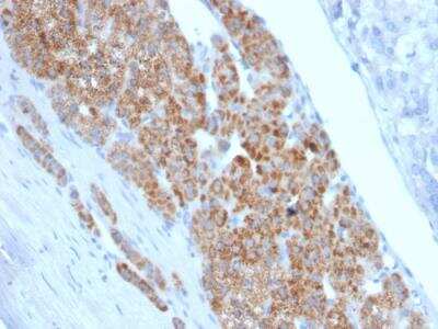 Immunohistochemistry-Paraffin: StAR Antibody (STAR/2140) - Azide and BSA Free [NBP2-75740]