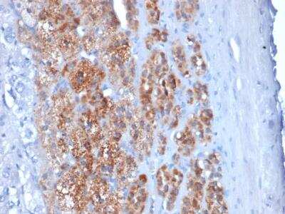 Immunohistochemistry-Paraffin: StAR Antibody (STAR/2154) [NBP2-75741]
