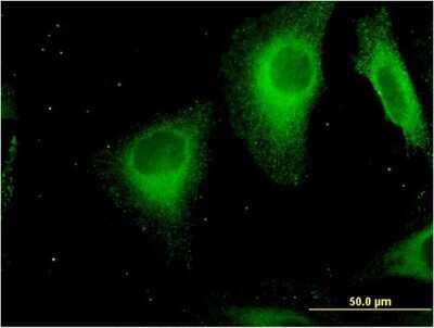Immunocytochemistry/ Immunofluorescence: Stabilin-1 Antibody (4G9) [H00023166-M05]