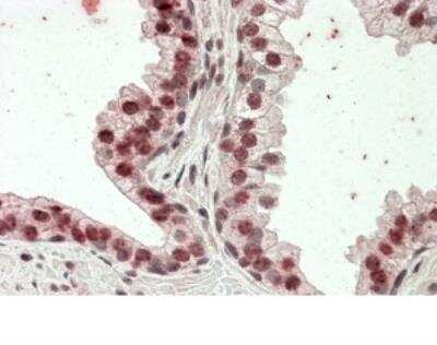Immunohistochemistry-Paraffin: Stabilin-1 Antibody [NBP1-52152]