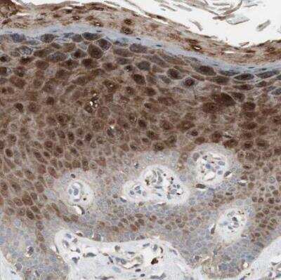 Immunohistochemistry-Paraffin: Stabilin-1 Antibody [NBP1-84444]