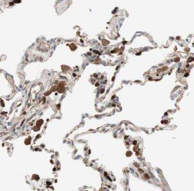 Immunohistochemistry-Paraffin: Stabilin-1 Antibody [NBP1-84444]