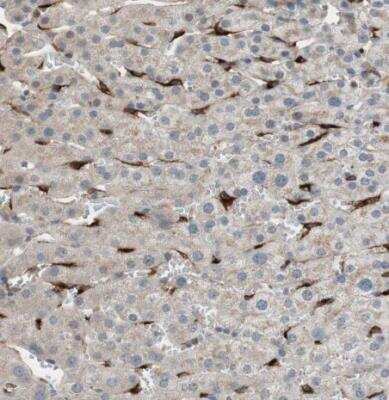 Immunohistochemistry-Paraffin: Stabilin-1 Antibody [NBP1-84444]