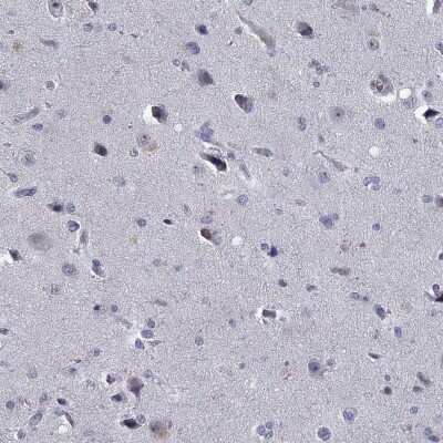 Immunohistochemistry-Paraffin: Stabilin-2 Antibody [NBP3-17092]