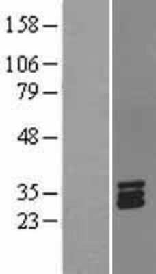 Western Blot: Stanniocalcin 1/STC-1 Overexpression Lysate [NBL1-16533]