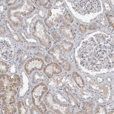 Immunohistochemistry-Paraffin: Stanniocalcin 1/STC-1 Antibody [NBP1-87816]