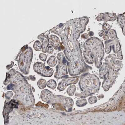 Immunohistochemistry-Paraffin: Stanniocalcin 1/STC-1 Antibody [NBP1-87816]