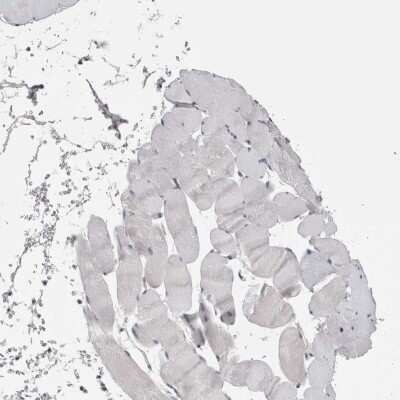 Immunohistochemistry-Paraffin: Stanniocalcin 1/STC-1 Antibody [NBP1-87816]