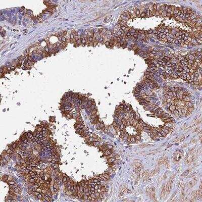 Immunohistochemistry-Paraffin: Stanniocalcin 2/STC-2 Antibody [NBP1-92447]