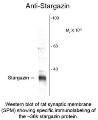 Western Blot: Stargazin Antibody [NB100-61089]