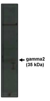 Western Blot: Stargazin Antibody [NBP3-11902]