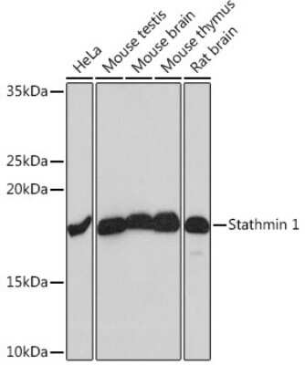 Western Blot: Stathmin 1 Antibody (7Y7H4) [NBP3-16396]