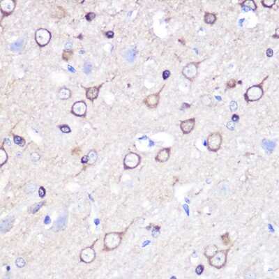 Immunohistochemistry-Paraffin: Stathmin 1 Antibody - Azide and BSA Free [NBP2-93761]