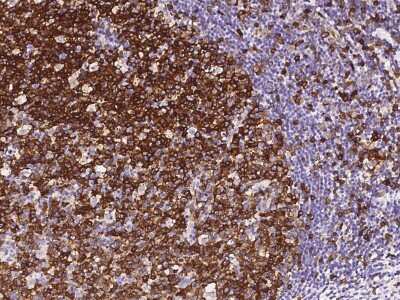 Immunohistochemistry-Paraffin: Stathmin 1 Antibody [NBP2-98752]