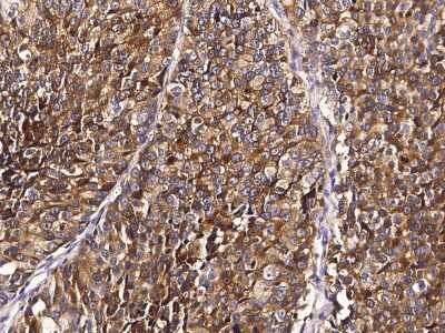 Immunohistochemistry-Paraffin: Stathmin 1 Antibody [NBP2-98752]