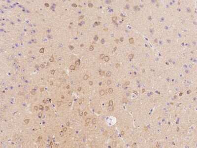 Immunohistochemistry-Paraffin: Stathmin 1 Antibody [NBP2-99433]