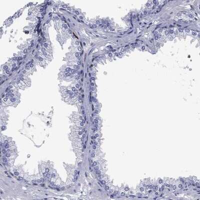 Immunohistochemistry-Paraffin: Stathmin 1 Antibody [NBP3-16977]