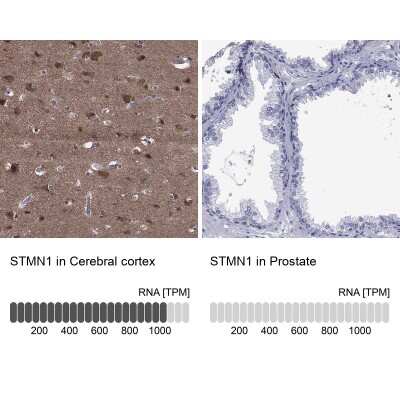 Immunohistochemistry-Paraffin: Stathmin 1 Antibody [NBP3-16977]