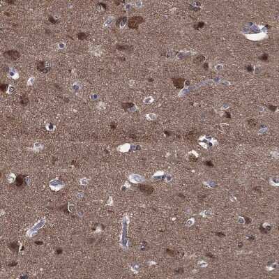 Immunohistochemistry-Paraffin: Stathmin 1 Antibody [NBP3-16977]