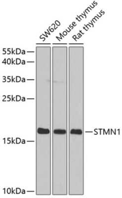 Western Blot: Stathmin 1 AntibodyAzide and BSA Free [NBP2-93761]