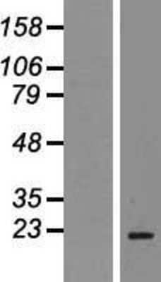 Western Blot: Stathmin 1 Overexpression Lysate [NBP2-04564]