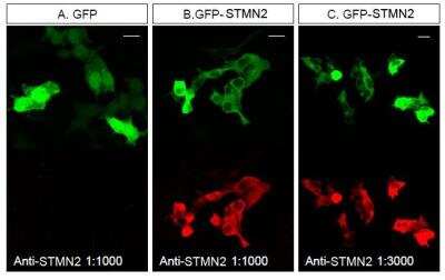 Immunocytochemistry/Immunofluorescence Staining of Stathmin-2/STMN2 in Transfected HEK293T Cells