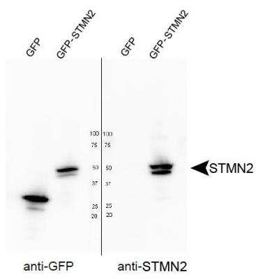 Western Blot Analysis of Stathmin-2/STMN2 in Transfected HEK293T Cells