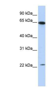 Western Blot: Staufen Antibody [NBP1-57386]