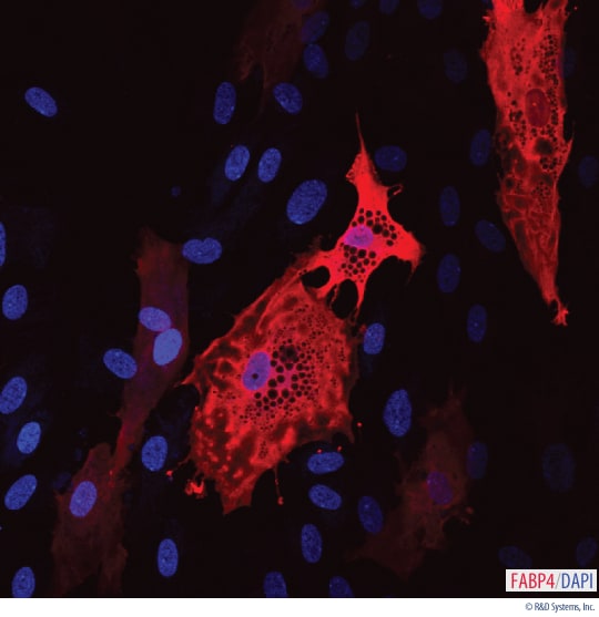 Detection of FABP4 in Human MSC-differentiated Adipocytes.