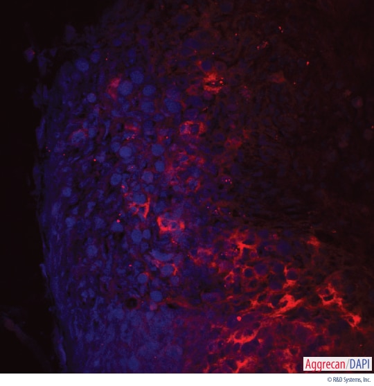 Detection of Aggrecan in a Human MSC-differentiated Chondrogenic Pellet Section.