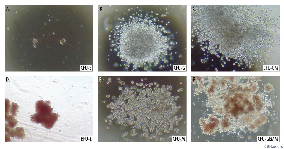Human Hematopoietic Colony Formation Using the Methylcellulose-based Colony Forming Cell Assay. 