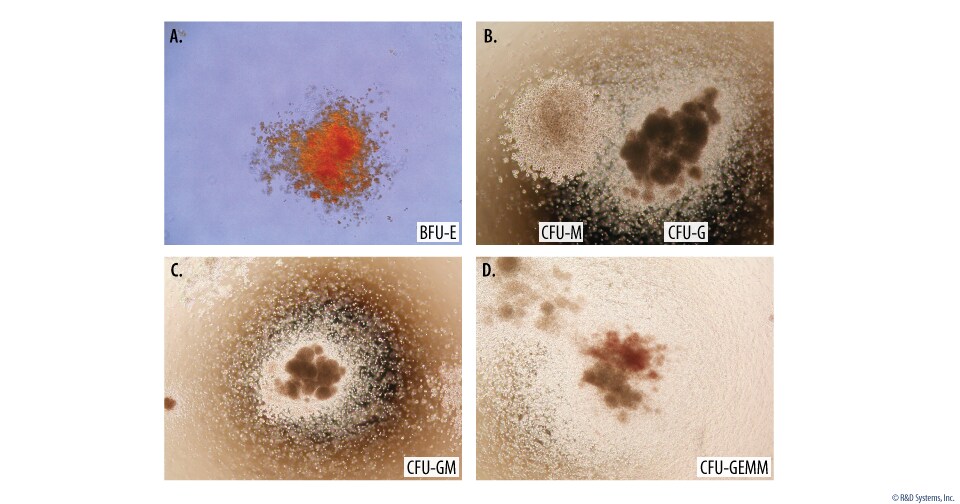 Mouse Hematopoietic Colony Formation Using the Methylcellulose-based Colony Forming Cell Assay. 