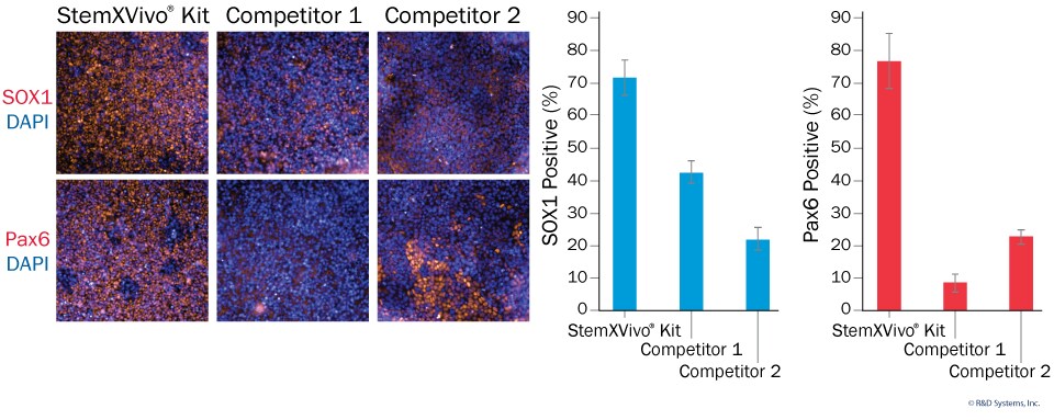 StemXVivo® Neural Progenitor Differentiation Kit Has Superior Performance Compared to Other Commercially Available Kits.