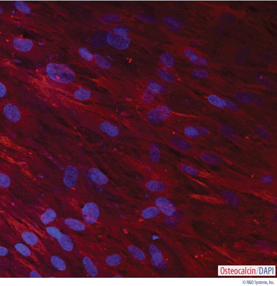 Detection of Osteocalcin in Human MSCs-differentiated Osteocytes. 