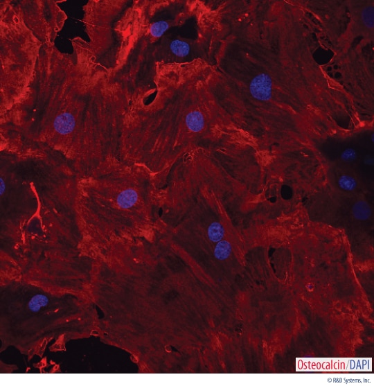 Detection of Osteocalcin in Rat MSC-differentiated Osteocytes. 