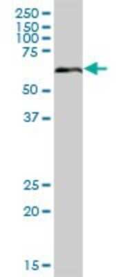 Western Blot: Steroid sulfatase Antibody [H00000412-B01P]