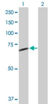Western Blot: Steroid sulfatase Antibody [H00000412-D01P]