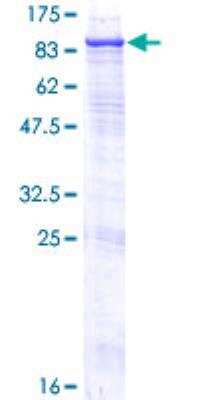 SDS-PAGE: Recombinant Human Steroid sulfatase GST (N-Term) Protein [H00000412-P01]