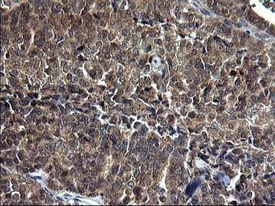Immunohistochemistry: Sterol carrier protein 2 Antibody (OTI1E4) [NBP2-45726]