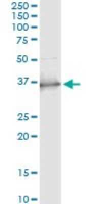 Immunoprecipitation: Sterol carrier protein 2 Antibody (2E9-1B3) [H00006342-M01]