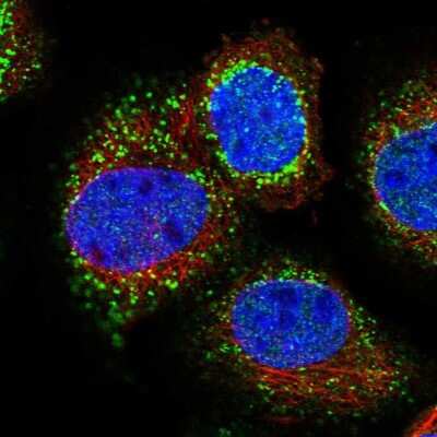 Immunocytochemistry/ Immunofluorescence: Sterol carrier protein 2 Antibody [NBP1-89514]