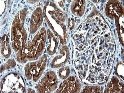 Immunohistochemistry: Sterol carrier protein 2 Antibody (OTI1E4) - Azide and BSA Free [NBP2-74401]