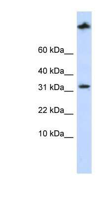 Western Blot: Sterol carrier protein 2 Antibody [NBP1-55214]